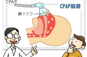 Cpap2